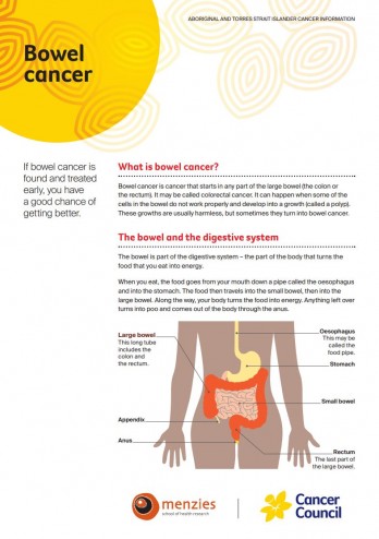 Bowel cancer factsheet