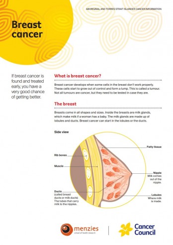 Breast cancer factsheet