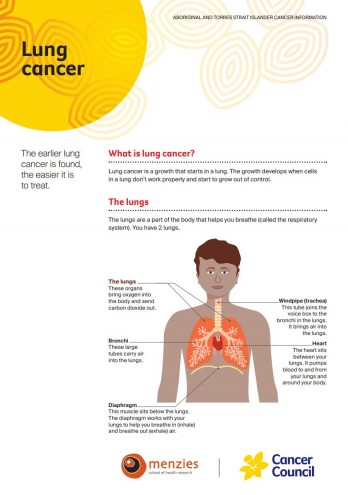 Lung cancer factsheet